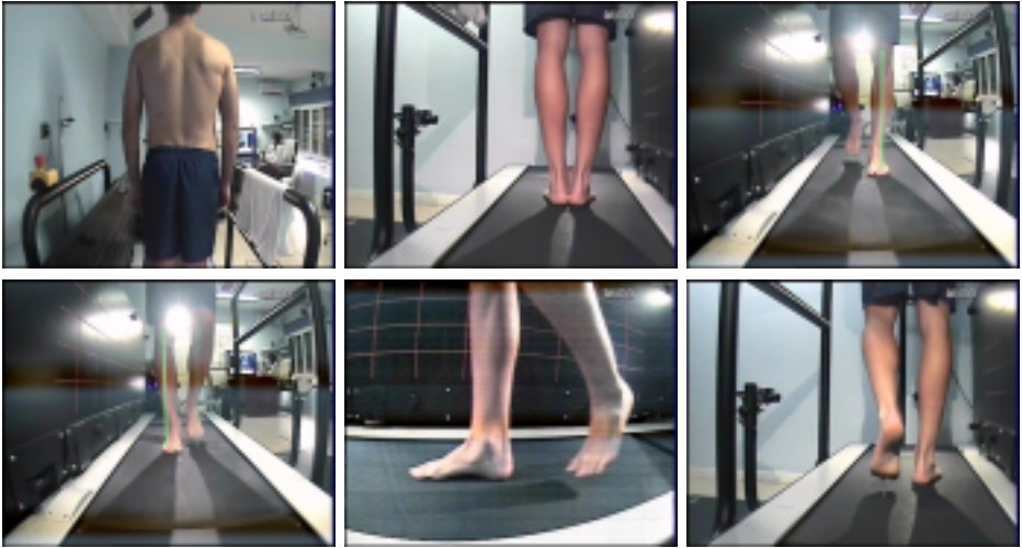 interfisio-fisioterapia-malaga-carlos-perez-cabeza7